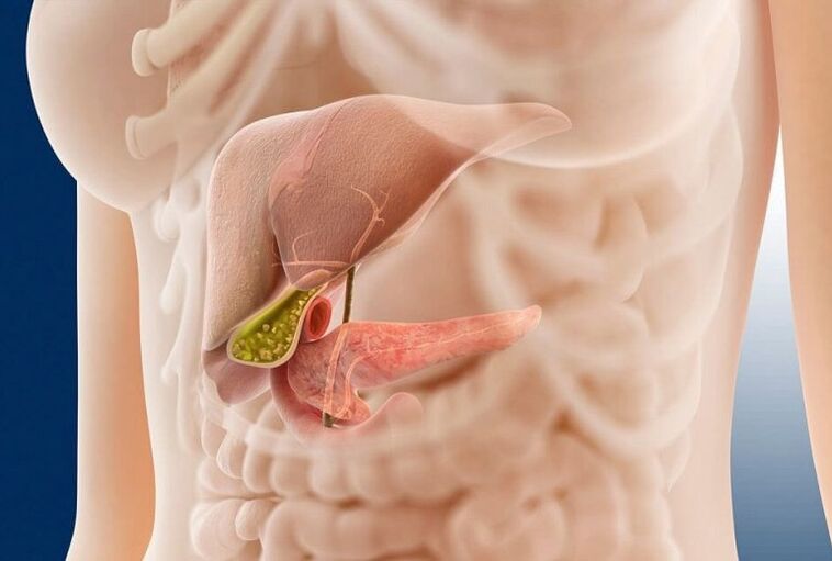 O que é pancreatite
